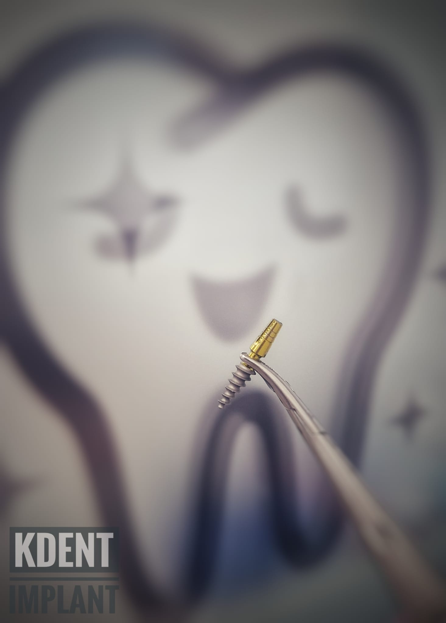 implanturi dentare KDENT