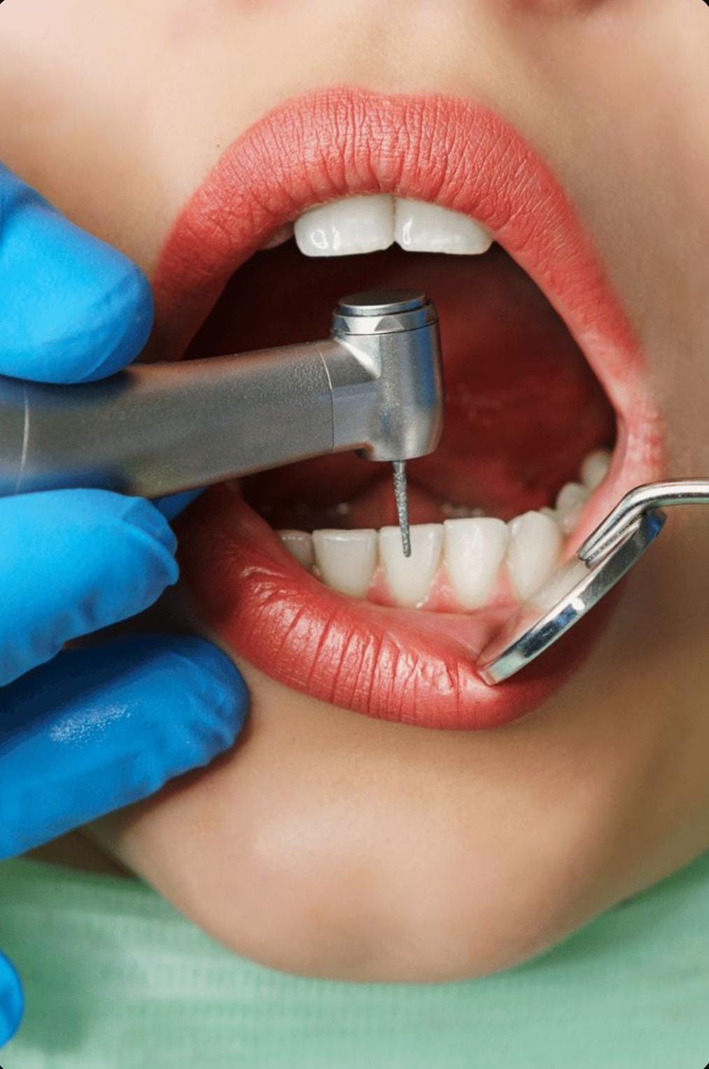 Chirurgia dentara KDENT